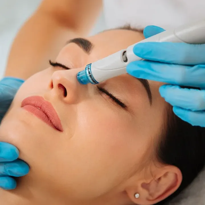 HydraFacial — преди (демо)