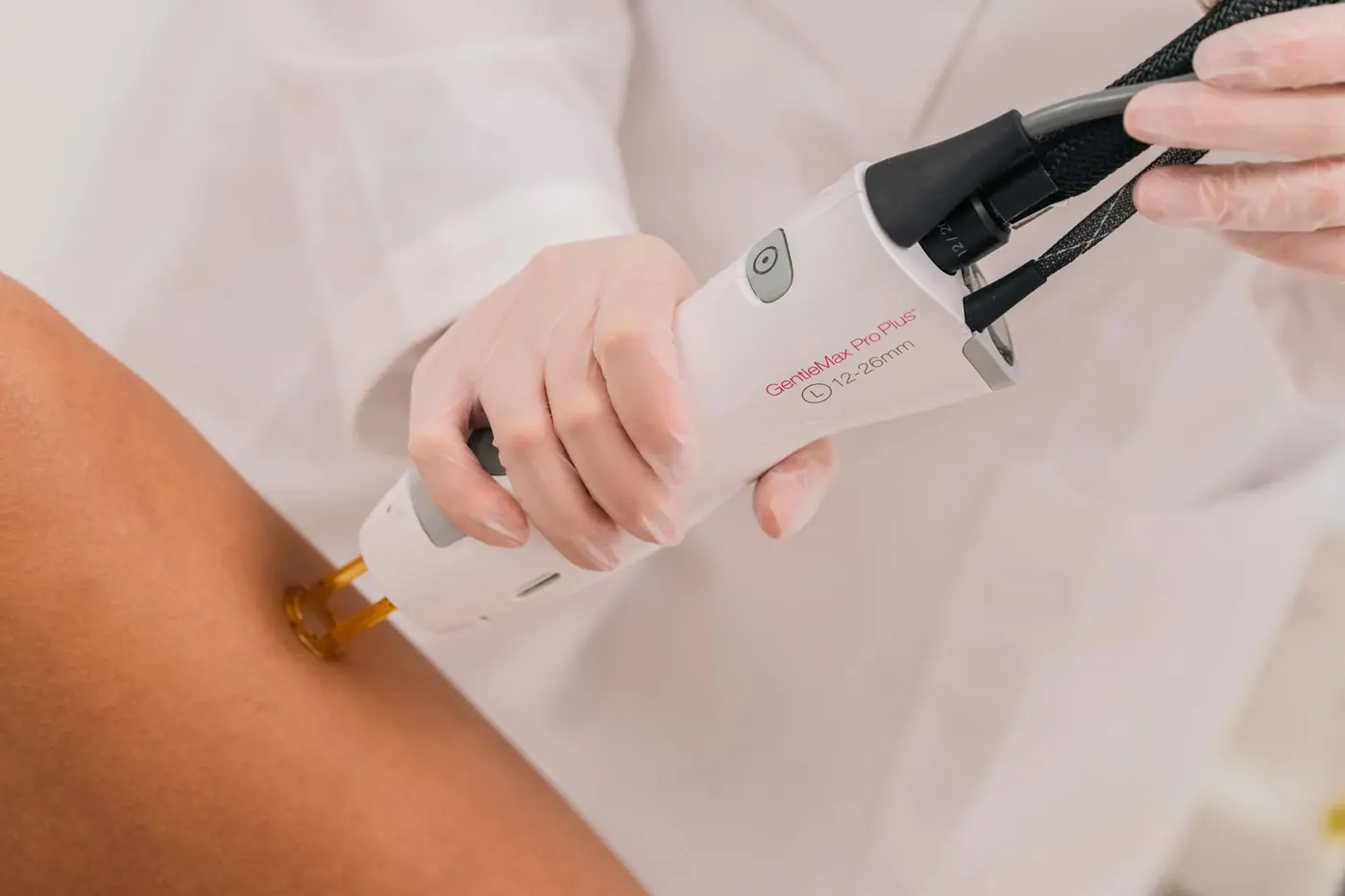 Лазерна епилация с Candela GentleLase Pro